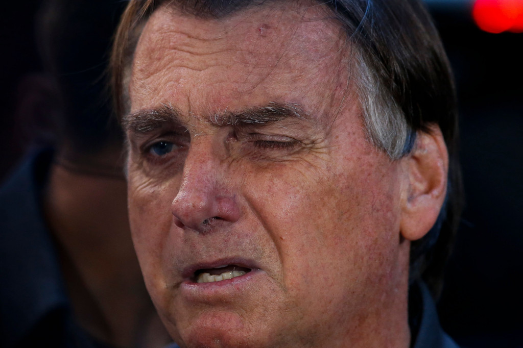 Jair Bolsonaro telah dioperasi sebanyak enam jali sejak ditusuk di bagian perut pada 2018 saat berkampanye.