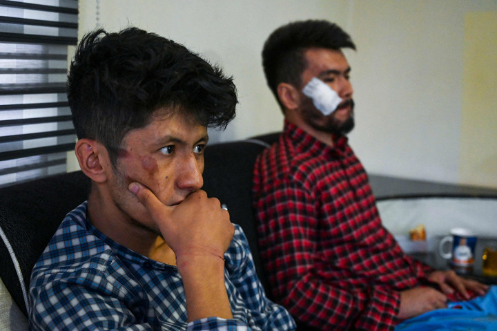 “Kami sudah mengatakan pada mereka bahwa kami ini wartawan, namun mereka tidak peduli. Saya pikir mereka akan membunuh kami, tetapi mereka terus mengolok-olok kami ,” kata Naqdi seperti dikutip dari LA Times.