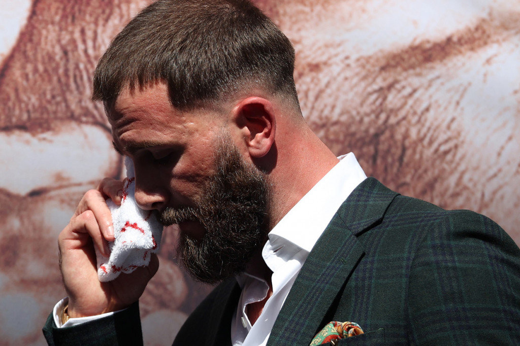 Plant diketahui mengalami luka di bawah mata kanan akibat pertarungan jarak dekat tersebut.