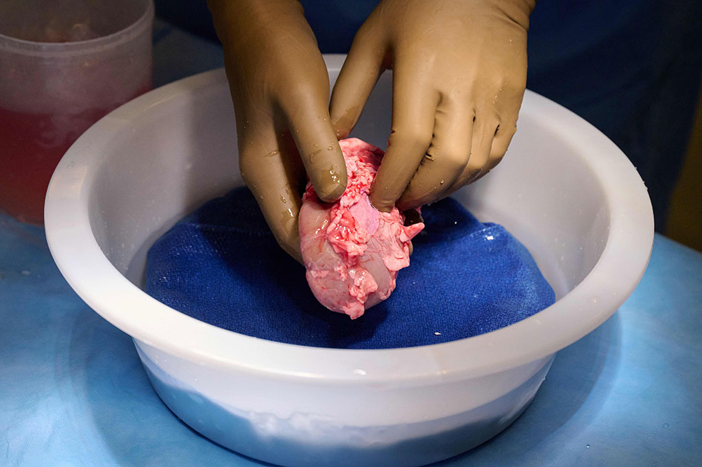 Foto milik NYU Langone Health memperlihatkan ginjal babi yang direkayasa secara genetik dibersihkan dan disiapkan untuk ditransplantasikan ke manusia. Sebuah tim medis AS telah berhasil untuk sementara menempelkan ginjal babi ke seseorang, terobosan transplantasi dipuji sebagai keajaiban potensial oleh ahli bedah yang memimpin prosedur.