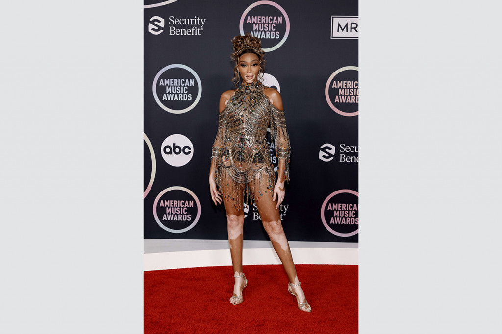 Winnie Harlow berhasil mencuri perhatian lewat outfit high couture yang ia kenakan. Winnie terlihat seperti prajurit jaman Roman Yunani dalam balutan cutout chain dress warna tembaga, keluaran rumah mode ternama Zuhair Murad.