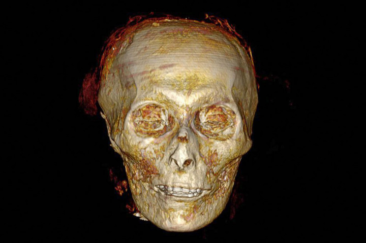 Mesir telah membuka secara digital mumi Firaun Amenhotep I yang terkenal, mengungkapkan rahasiaa untuk pertama kalinya sejak ditemukan pada  1881 tanpa mengganggu topeng penguburannya.