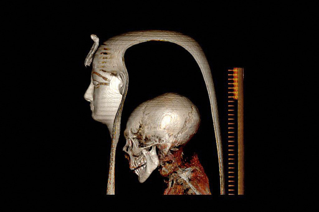 Penelitian Mesir mengungkapkan untuk pertama kalinya wajah Raja Amenhotep I, usianya, kondisi kesehatannya, selain banyak rahasia tentang mumifikasi dan penguburan mumi yang unik. Pemindaian tomografi mengungkapkan bahwa firaun, meninggal pada usia 35 tahun, tampaknya karena cedera atau sakit.