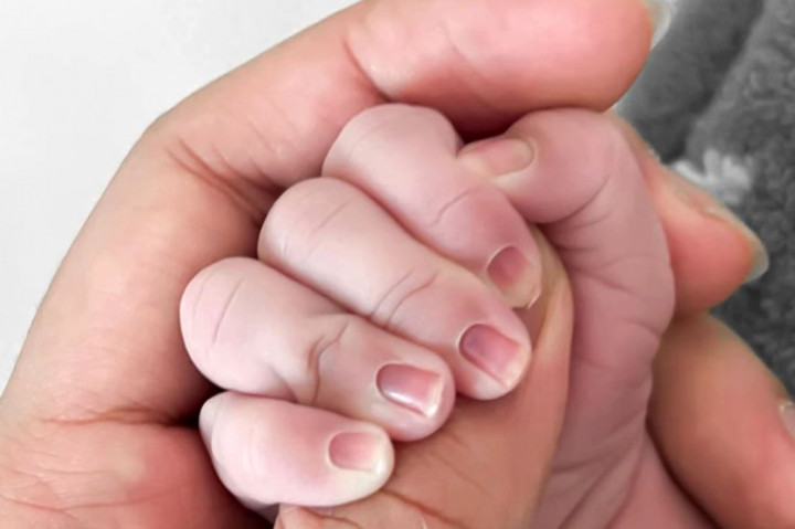 Pasangan selebriti Aurel Hermansyah dan Atta Halilintar tengah berbahagia. Mereka dikaruniai anak pertama berjenis kelamin perempuan di Rumah Sakit Bunda Jakarta, Selasa, 22 Februari 2022.