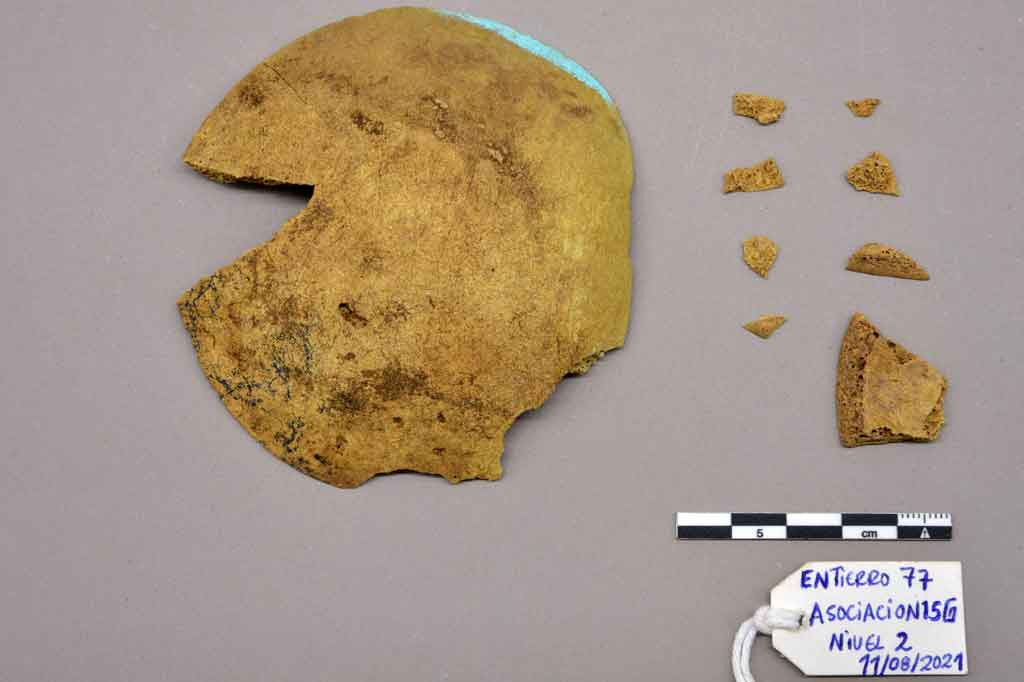 Beberapa elemen ditemukan di makam ahli bedah yang dikuburkan dengan mengenakan topeng emas tersebut.