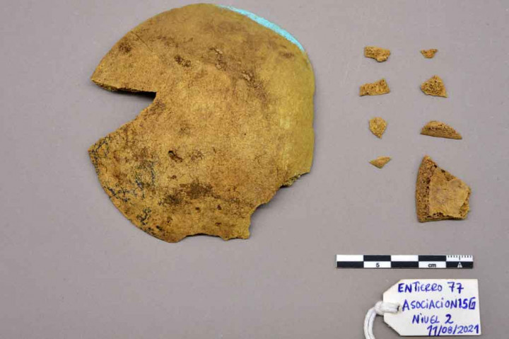 Beberapa elemen ditemukan di makam ahli bedah yang dikuburkan dengan mengenakan topeng emas tersebut.