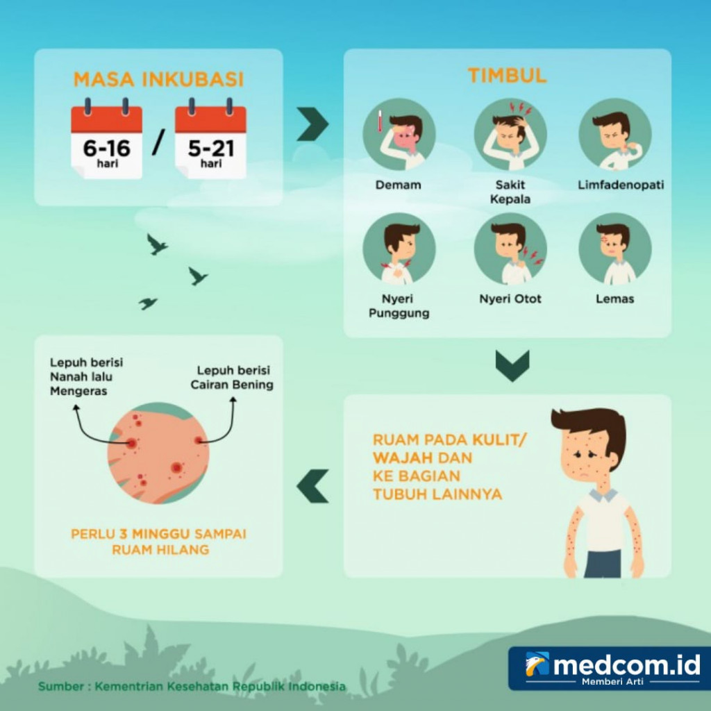 Gejala dan Tanda Cacar Monyet