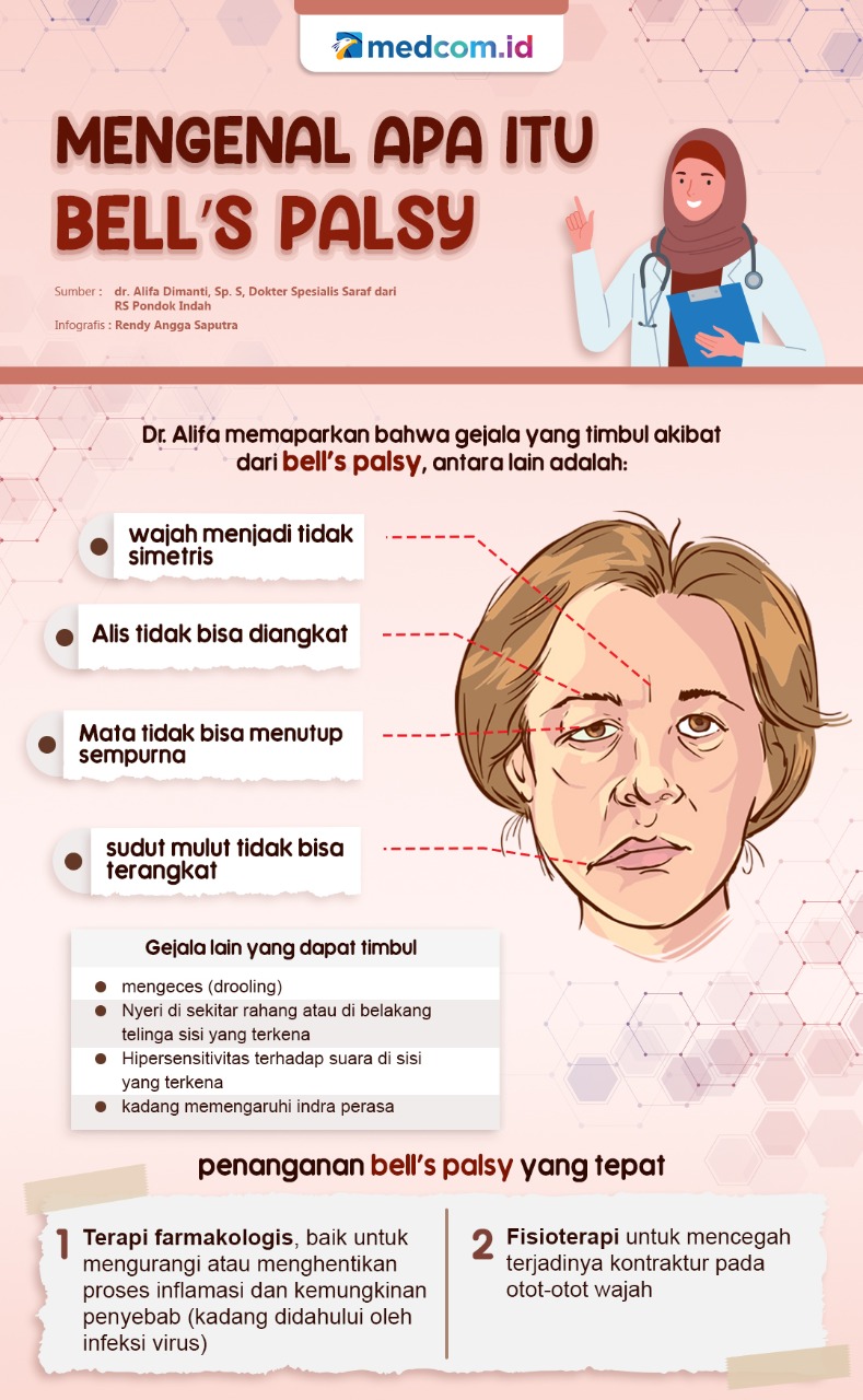Mengenal Apa Itu Bell’s Palsy