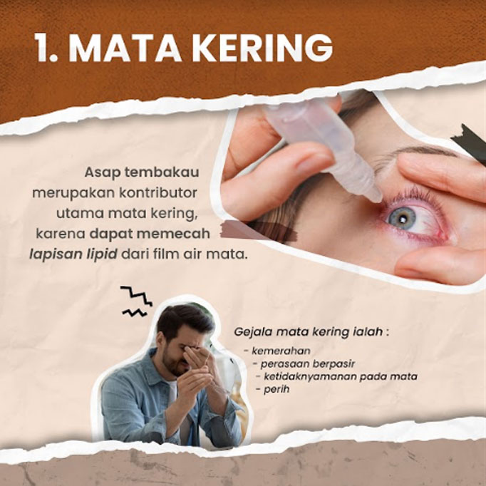 Empat Dampak Buruk Merokok pada Mata