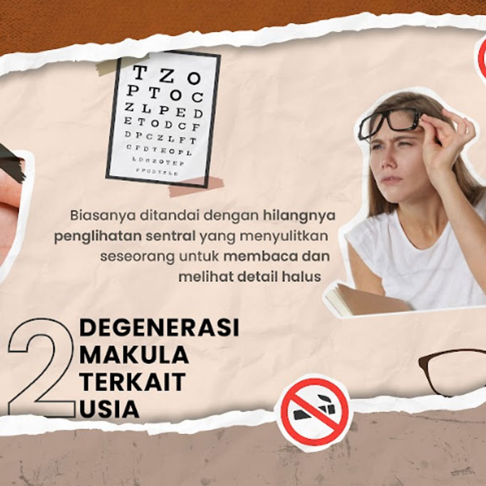 Empat Dampak Buruk Merokok pada Mata