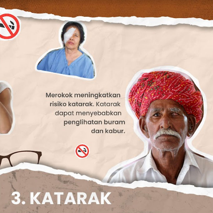 Empat Dampak Buruk Merokok pada Mata