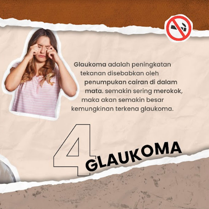 Empat Dampak Buruk Merokok pada Mata