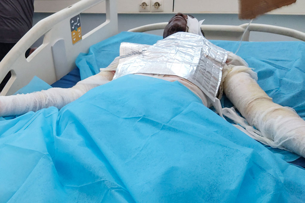 Ledakan terjadi ketika banyak orang berkerumun di sekitar truk tanker yang akan menuju ke sebuah pompa bensin di distrik Bent Bayyah. Sebuah penyerbuan terjadi, diikuti oleh ledakan besar yang membakar beberapa mobil, menurut gambar yang diposting online.