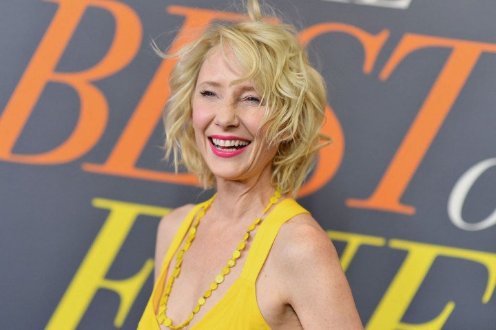 Aktris AS Anne Heche telah dirawat di rumah sakit dalam kondisi kritis setelah menabrakkan mobilnya ke sebuah rumah di Los Angeles.