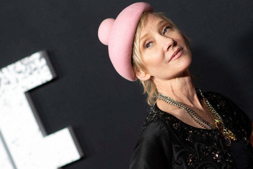 Aktris AS Anne Heche telah dirawat di rumah sakit dalam kondisi kritis setelah menabrakkan mobilnya ke sebuah rumah di Los Angeles.