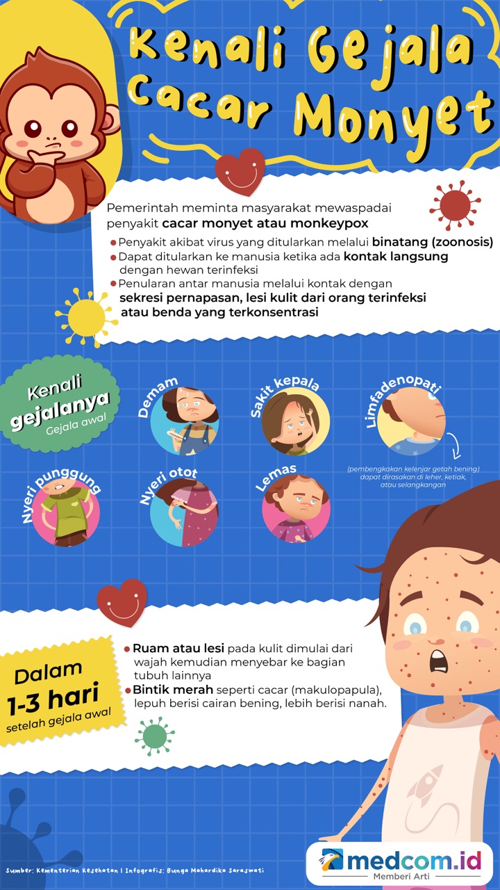 Kenali Gejala Cacar Monyet