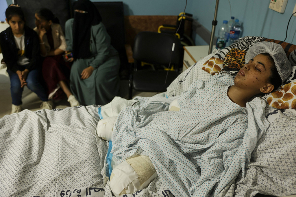 Gadis Palestina Rahaf Salman, 11, yang kehilangan anggota tubuhnya dalam konflik terbaru antara Israel dan militan Palestina, menerima perawatan di sebuah rumah sakit di kamp pengungsi Jabalia di Jalur Gaza, Selasa, 9 Agustus 2022.
