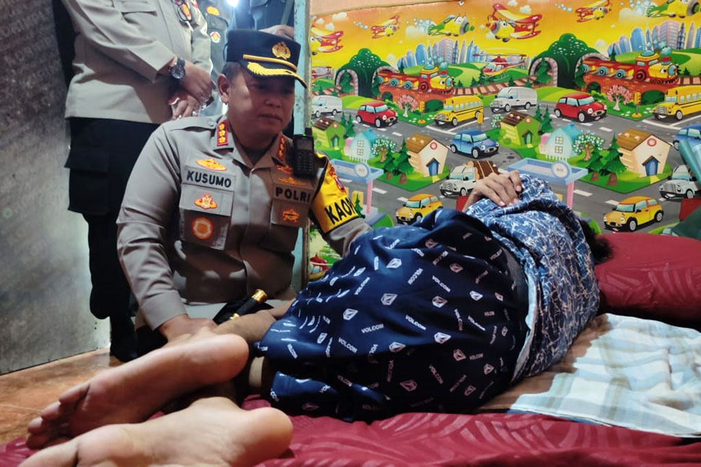 Vicky diperbolehkan pulang setelah dirawat di RSUD Kanjuruhan Malang selama satu bulan. Vicky masih membutuhkan penanganan intensif karena masih mengalami trauma. Dia terlihat ketakutan saat melihat keramaian dan belum bisa duduk. Aktivitas makan dan minum pun masih harus disuapi.