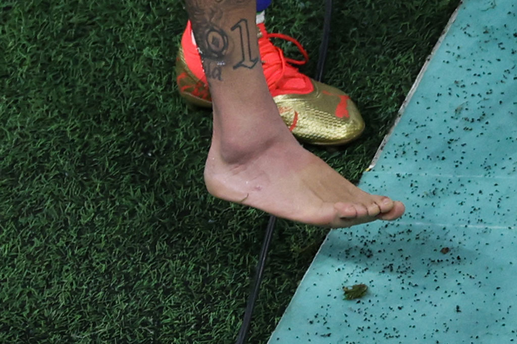 Neymar terlihat pincang setelah pertandingan, sementara foto sang striker menunjukkan pembengkakan pada pergelangan kaki kanannya.