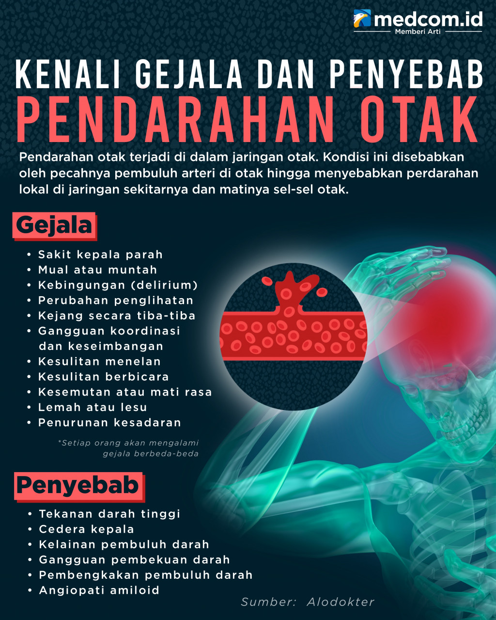Kenali Gejala dan Penyebab Pendarahan Otak
