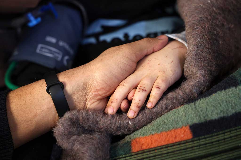 Dalam kondisi yang dikenal dengan istilah medis rhabdomyolysis, serat otot mati dan terlepas ke aliran darah, dan terkadang menyebabkan gagal ginjal. Pasien pada awalnya tampak dalam kondisi baik sebelum mulai memburuk.