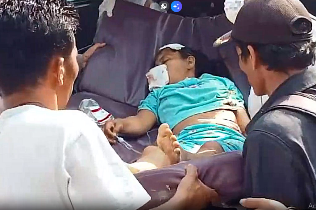 Kasat Lantas Polres Samosir AKP Yuswanto mengatakan kejadian bermula saat minibus angkutan dengan muatan 15 orang datang dari arah Nainggolan menuju Huta Siantarantar.