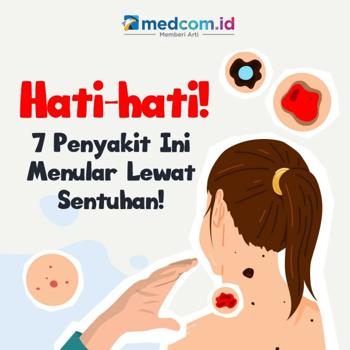 Waspadai, 7 Jenis Penyakit Kulit yang Menular lewat Sentuhan