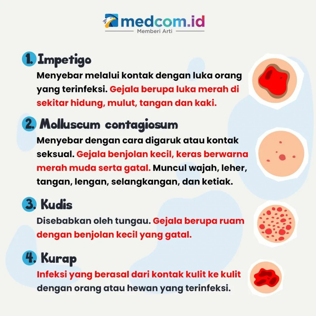 Waspadai, 7 Jenis Penyakit Kulit yang Menular lewat Sentuhan