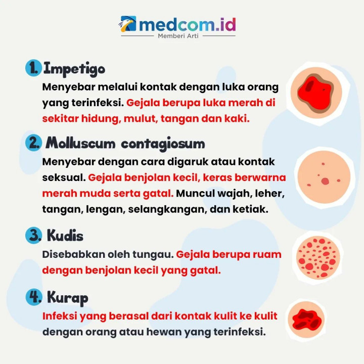 Waspadai, 7 Jenis Penyakit Kulit yang Menular lewat Sentuhan