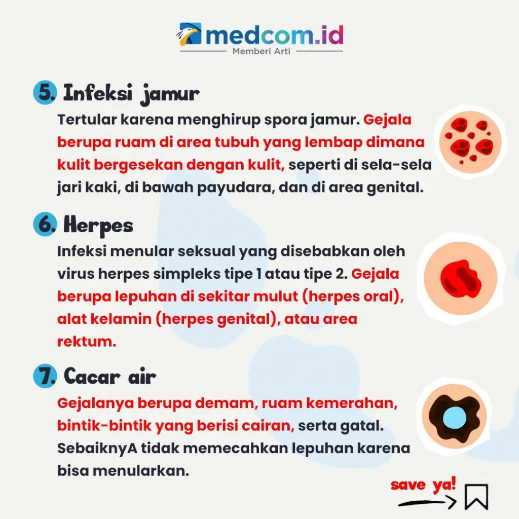 Waspadai, 7 Jenis Penyakit Kulit yang Menular lewat Sentuhan