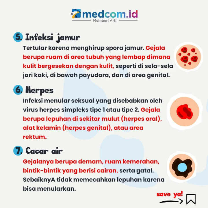 Waspadai, 7 Jenis Penyakit Kulit yang Menular lewat Sentuhan