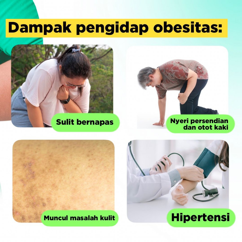 Kenali Dampak dan Pencegahan Obesitas