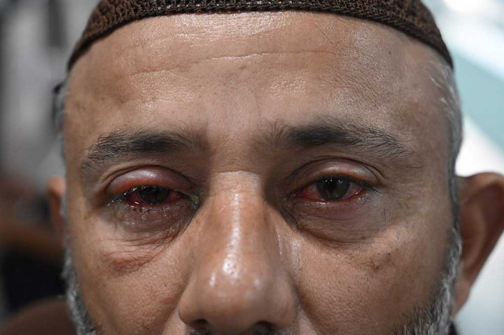 Jutaan siswa akan tinggal di rumah mulai besok setelah Punjab, provinsi terpadat di Pakistan, mengumumkan penutupan menyeluruh setelah mencatat 357.000 kasus konjungtivitis sejak awal tahun.