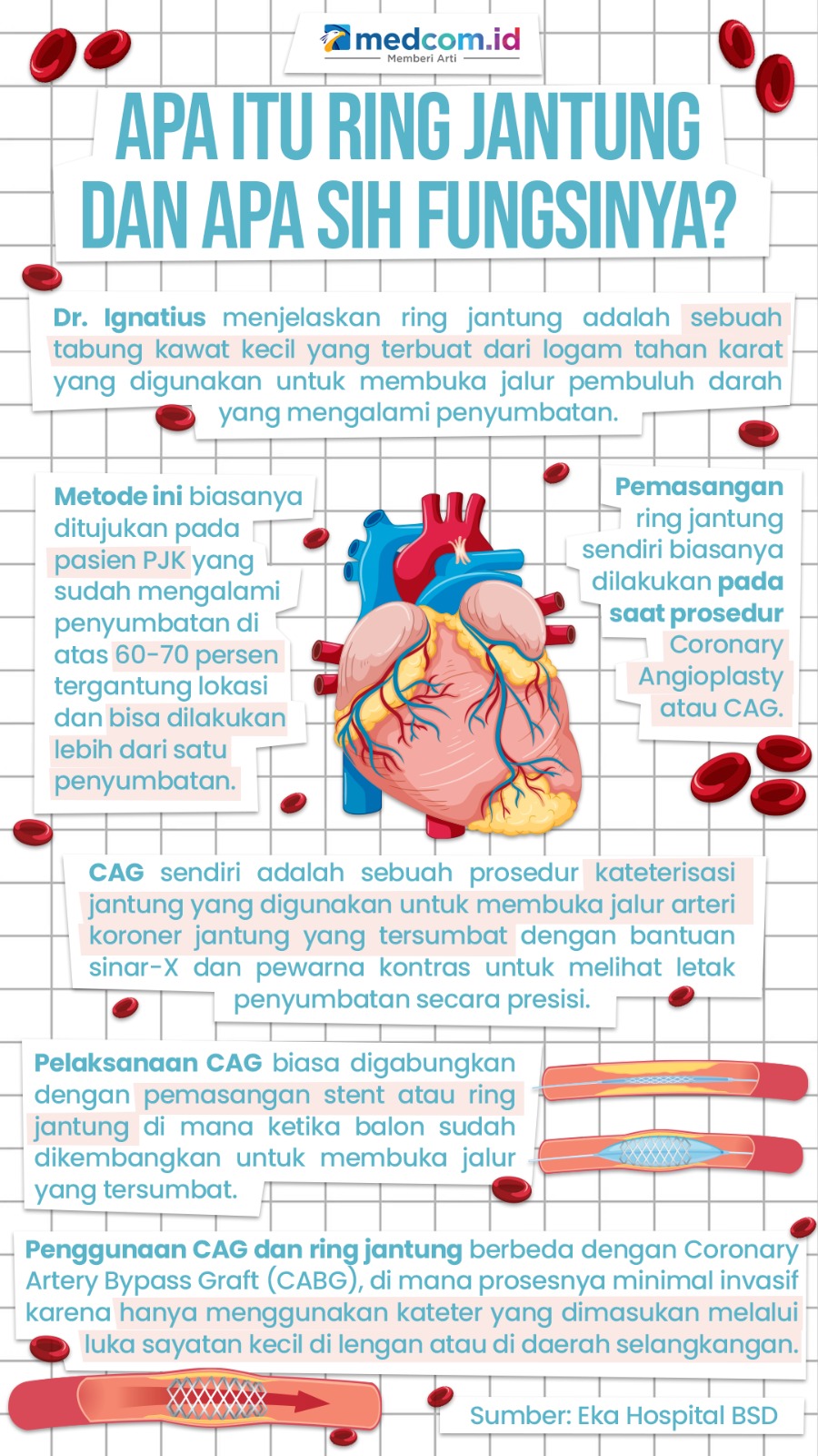 Apa Itu Ring Jantung dan Apa Fungsinya?