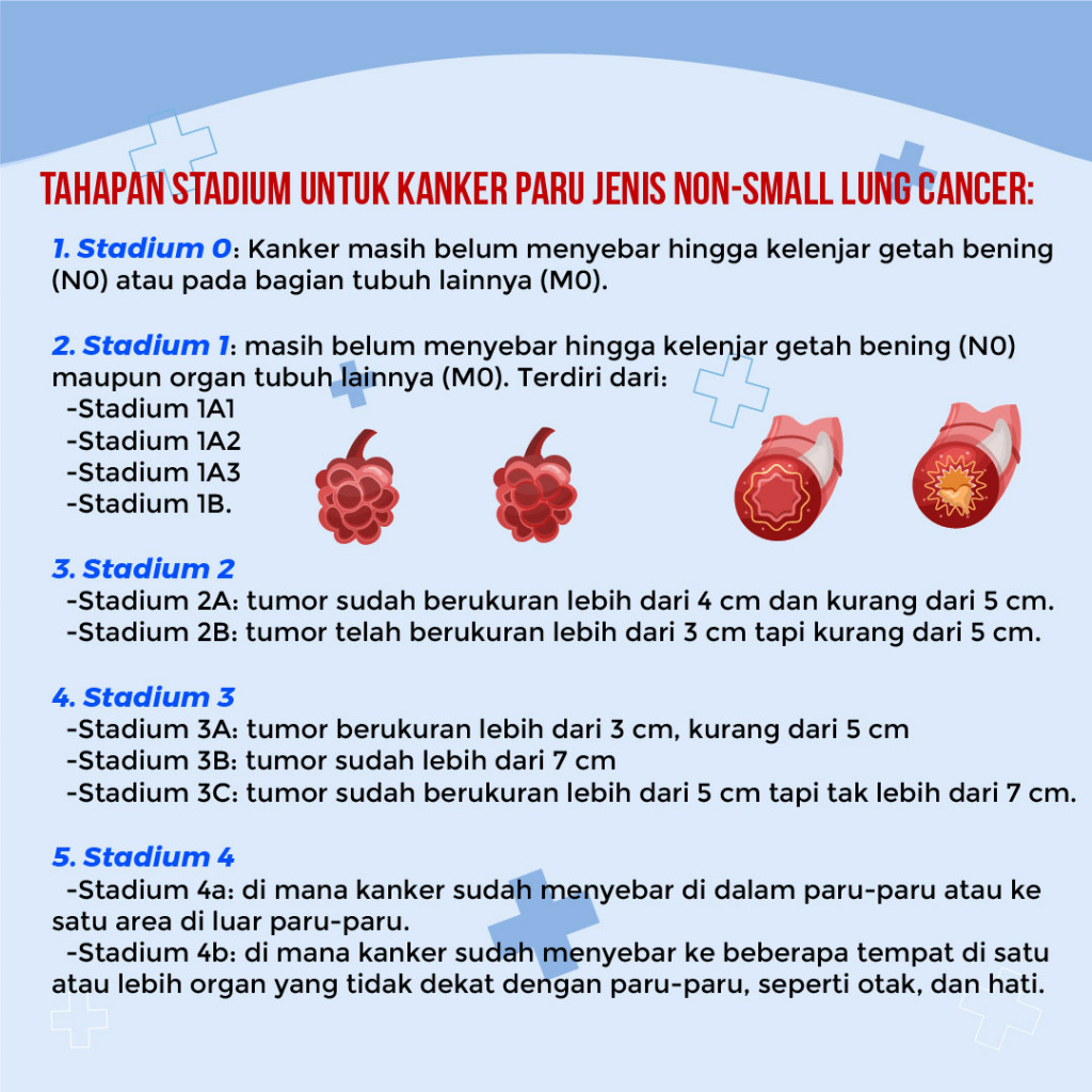 Apa itu Kanker Paru-paru?