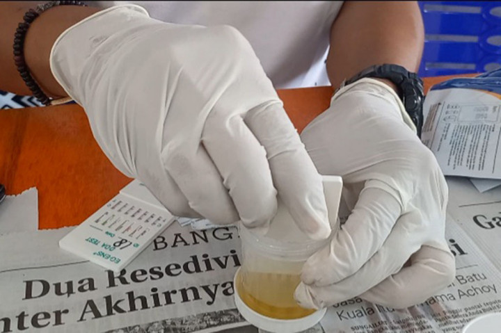 Kepala Dinas Sosial (Dinsos) Kabupaten Bangka Baharudin mengatakan tes urine atau tes narkoba ini Untuk memastikan honorer bebas narkoba.