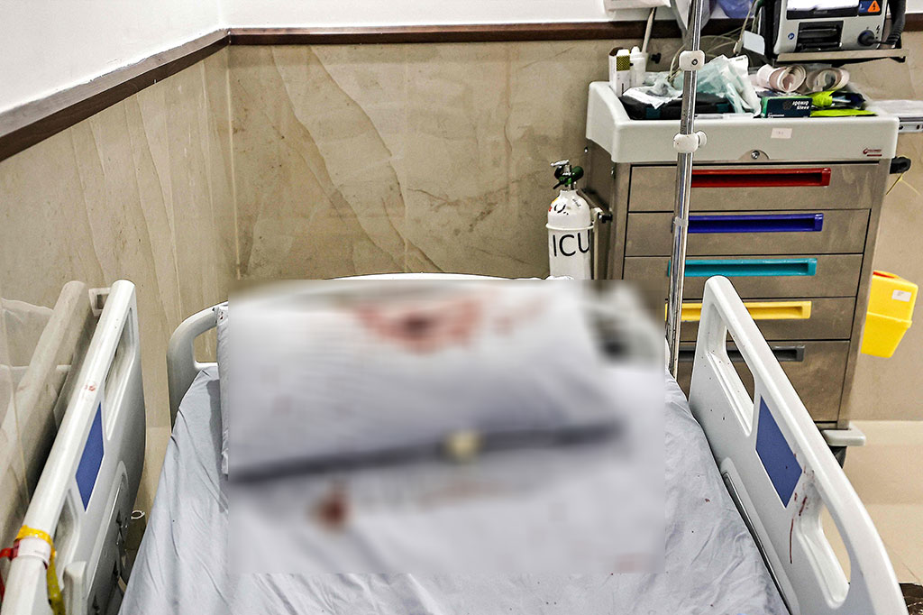 Sebuah lubang peluru digambarkan di atas bantal berlumuran darah di ranjang rumah sakit di RS Ibnu Sina di Jenin, Tepi Barat yang diduduki, Selasa, 30 Januari 2024.