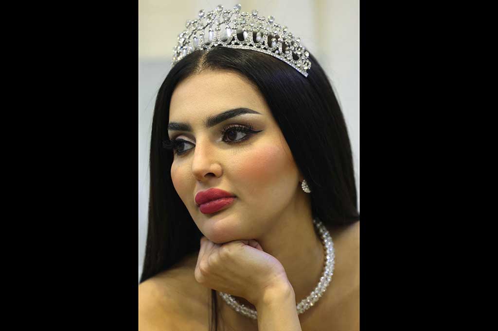 Partisipasi Miss Universe juga membawa fokus kembali pada bagaimana hak-hak perempuan telah mengalami perubahan besar dalam beberapa tahun terakhir di negara Muslim tersebut.