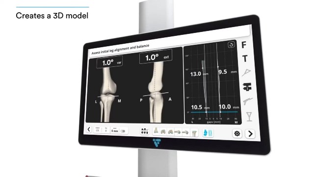 Dengan menggunakan VELYS Robotic, rasa sakit yang lebih minim dibandingkan dengan metode konvensional. (Foto: Dok. Mark Hood MD)