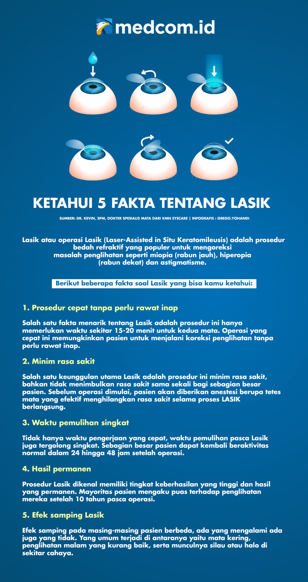 Ketahui 5 Fakta tentang Lasik