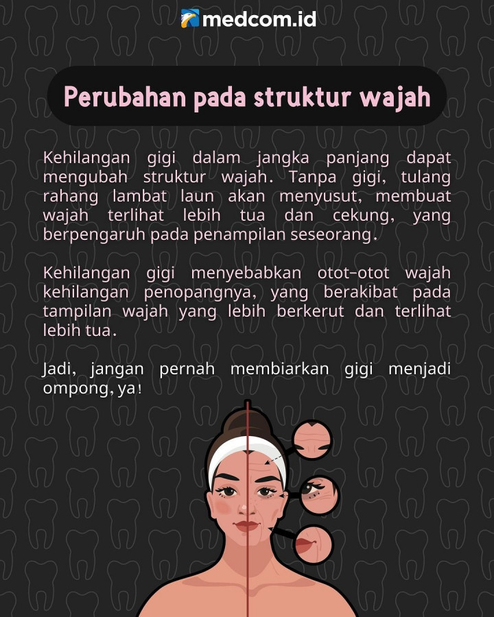 Ini 3 Dampak Jika Gigimu Dibiarkan Ompong