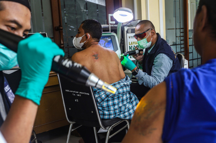Suasana berbeda terlihat di Masjid Sunda Kelapa, Jakarta, Senin, 23 Februari 2026. Sejumlah peserta mengikuti program hapus tato gratis yang digelar Baznas DKI Jakarta dengan menggunakan metode laser. Layanan ini menjadi salah satu rangkaian kegiatan sosial selama bulan suci Ramadan.