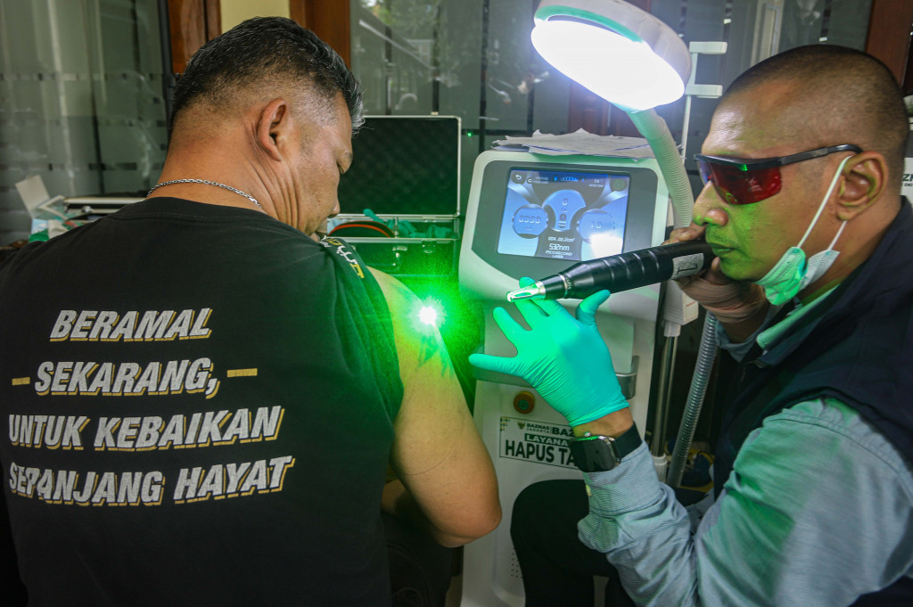 Melalui program ini, Baznas DKI Jakarta berharap dapat memberikan kesempatan bagi masyarakat yang ingin menghapus tato tanpa terbebani biaya. Selain menjadi bentuk layanan sosial, kegiatan ini juga diharapkan memberi semangat baru bagi peserta dalam menyambut Ramadan dengan perubahan yang lebih baik.