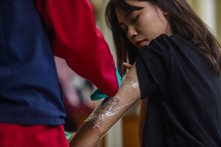 Petugas medis melakukan proses penghapusan tato secara bertahap dengan prosedur yang telah disesuaikan standar keamanan.