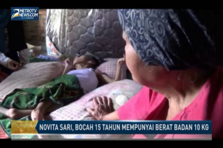 Bocah 15 Tahun ini Miliki Berat Badan Hanya 10 Kg