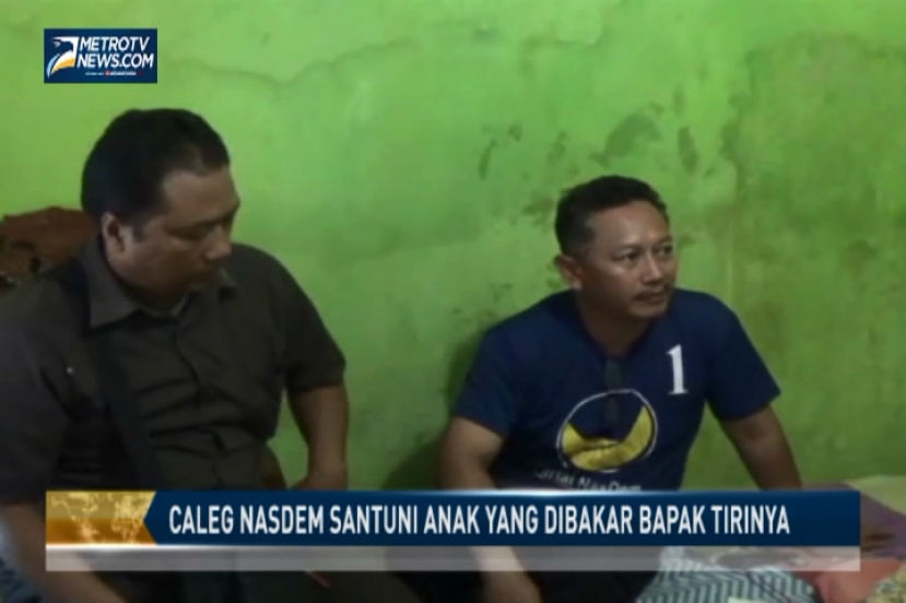 Caleg Nasdem Santuni Anak yang Dibakar Bapak Tirinya