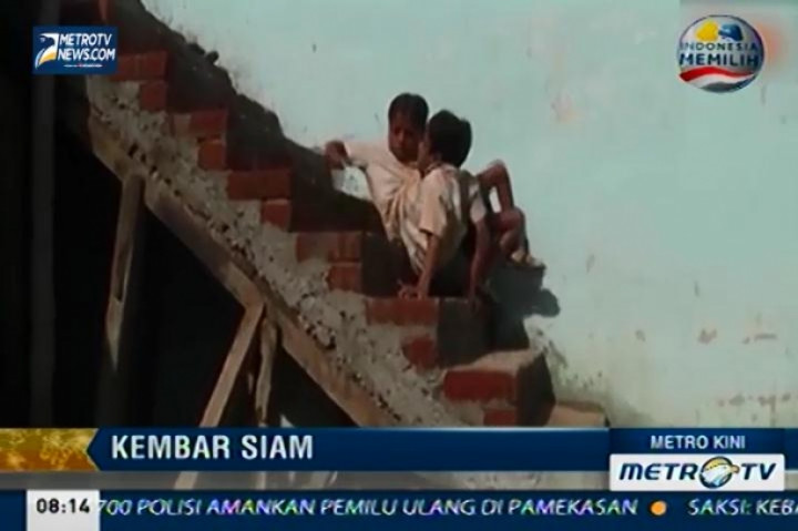 Kembar Siam