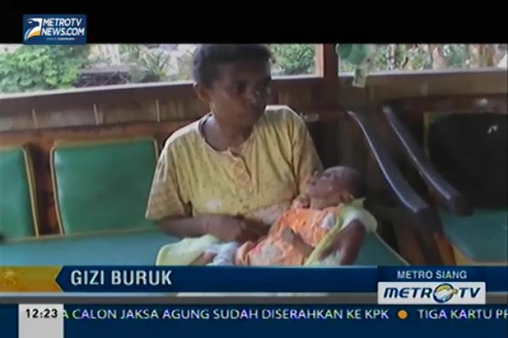 Kasus Gizi Buruk Masih Ditemukan di Indonesia