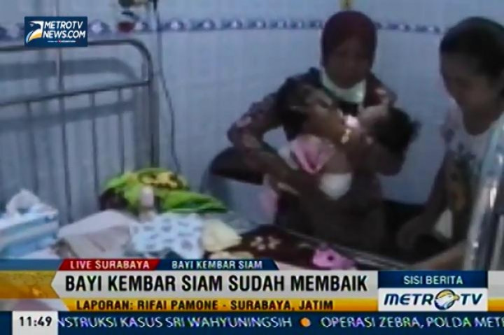 Syahrini-Syahrina Alhamdulillah Membaik 