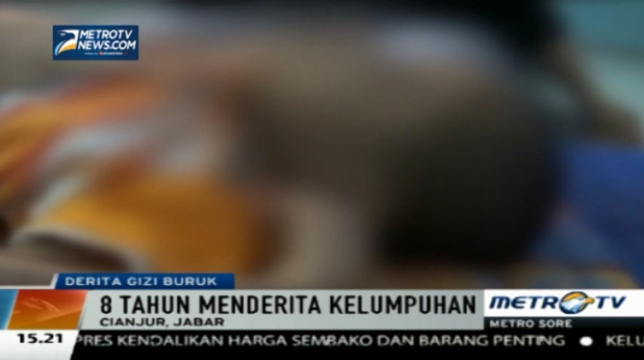 Miris, Bocah Ini Sudah 8 Tahun Menderita Gizi Buruk 